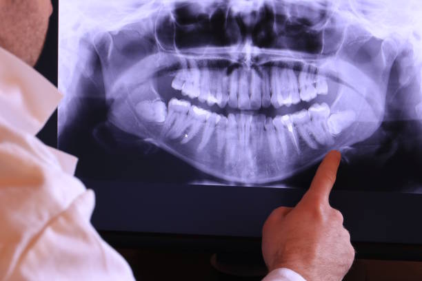 Best Emergency Gum Treatment in Tamalpais Homestead Valley, CA