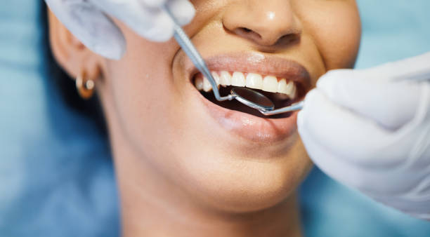 Best Emergency Dental Care for Broken or Chipped Teeth in Tamalpais Homestead Valley, CA