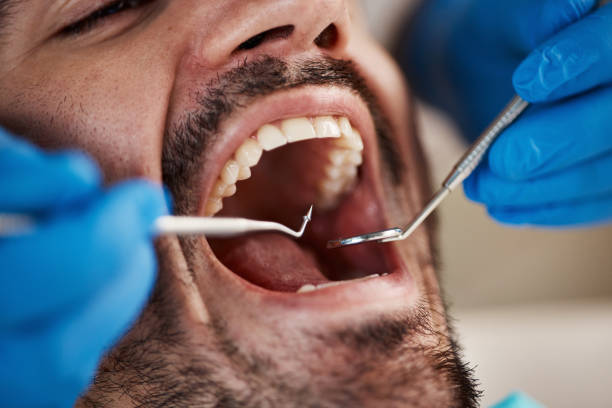Best Same-Day Emergency Dental Services in Tamalpais Homestead Valley, CA